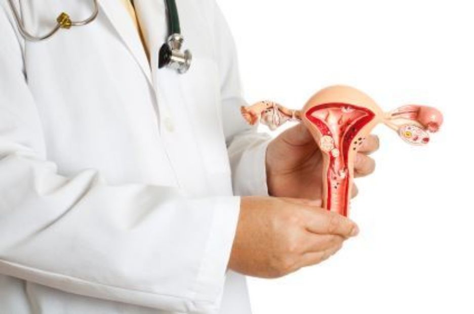 Czym jest endometrioza?