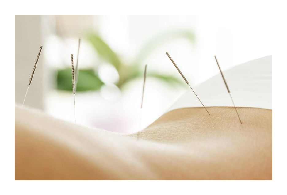 Na co pomaga akupresura i akupunktura?